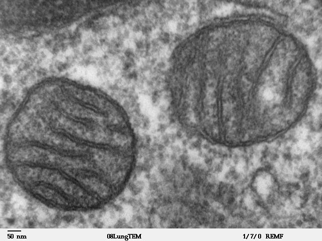 Transmission electron microscope image of a thin section cut through an area of mammalian lung tissue. The high magnification image shows a mitochondria. JEOL 100CX TEM