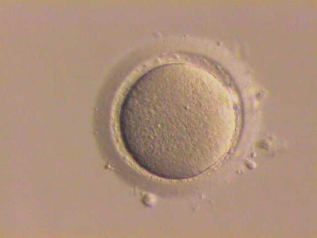 \Stripped\ human oocyte (egg cell); granulosa cells that had surrounded this oocyte have been removed.