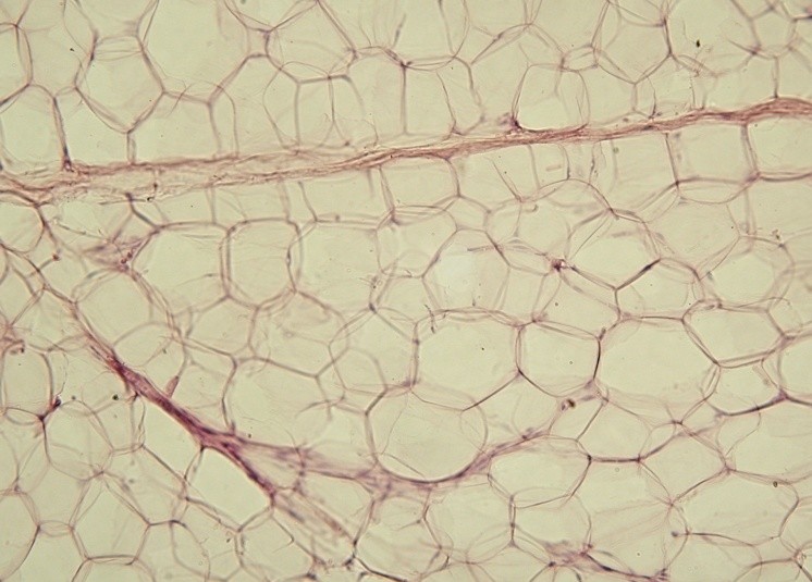 Fat cells in adipose tissue