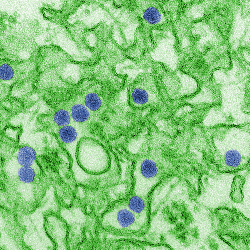Digitally-colorized transmission electron micrograph (TEM) of Zika virus, which is a member of the family Flaviviridae. Virus particles, here colored blue, are 40 nm in diameter, with an outer envelope, and an inner dense core.