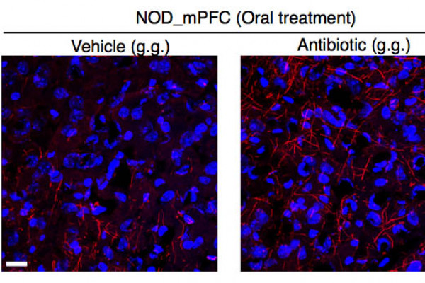 Myelin transcripts and myelinated fibers in the medial prefrontal cortex (mPFC) of adult NOD mice with social avoidance behavior.