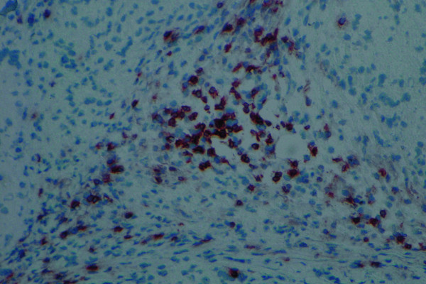 An infiltration of T cells, shown by dark brown colour, can be seen in the tissues formed by iPSCs.