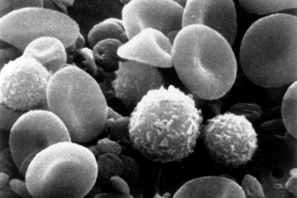 Electron microscopy of blood cells and platelets