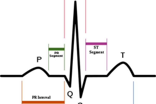 Schematic diagram of normal sinus rhythm for a human heart as seen on ECG (with English labels).