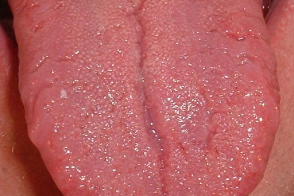 Human Tongue