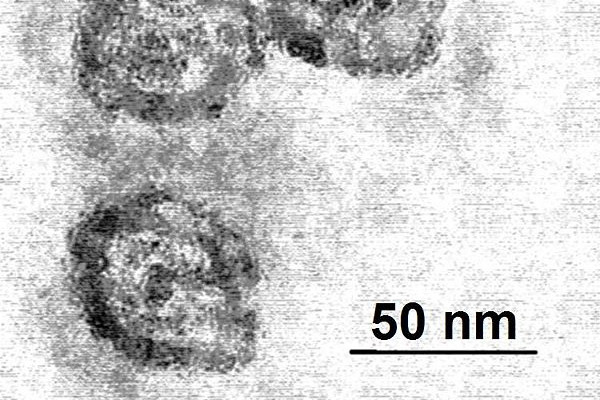 Electron microscope of Hepatitis C Virus
