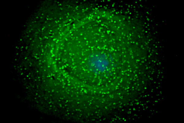 HIV-1 particles assembling at the surface of an infected macrophage.