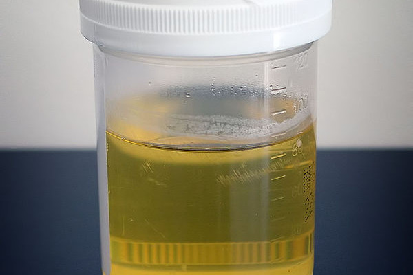 Urine sample