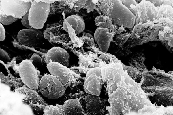 Scanning electron micrograph depicting a mass of Yersinia pestis bacteria (the cause of bubonic plague) in the foregut of the flea vector