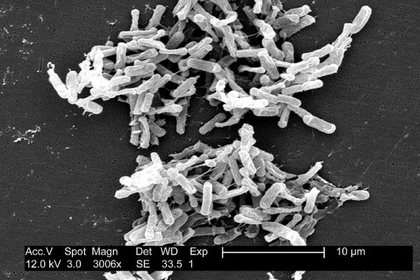 Clostridium difficile (C.diff) microbes seen under the electron microscope