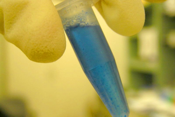 Brilliant Blue / Coomassie Blue staining protein; white flecks are DNA