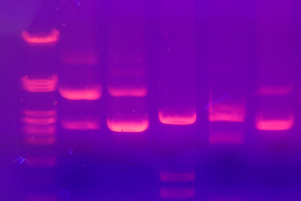 DNA electrophoresis