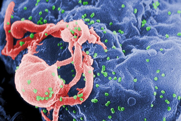 HIV viruses in green budding from a lymphocyte