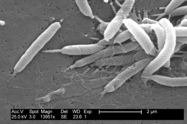 Scanning electron micrograph of Helicobacter bacteria