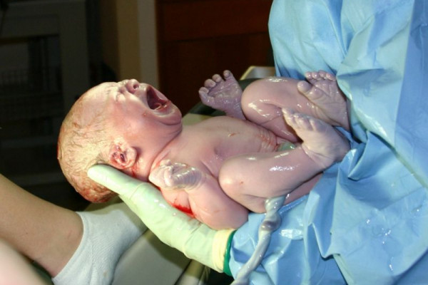 A newborn baby