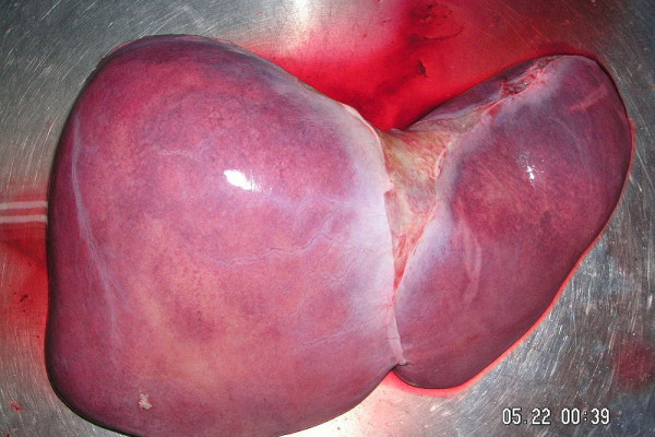 Human Liver