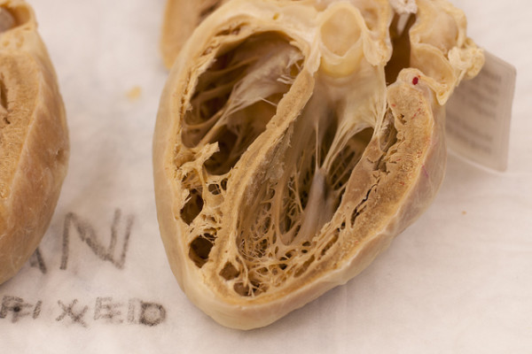 Human Heart Plastinate