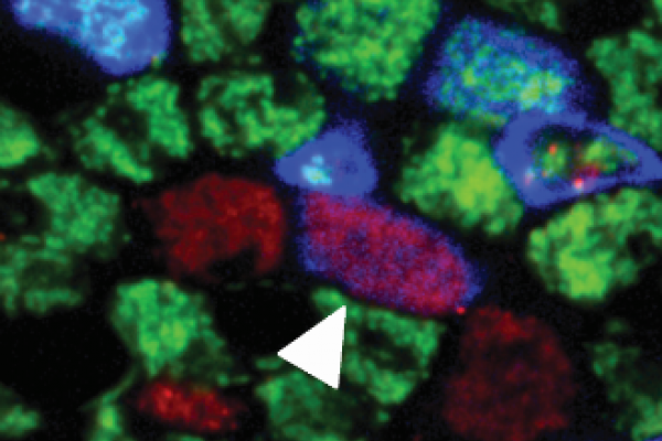 Human airway cells labelled