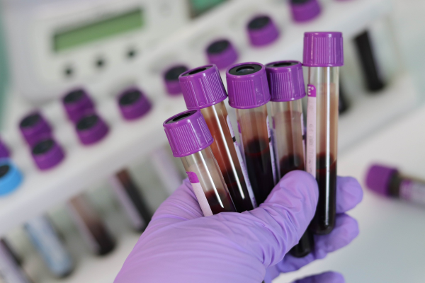 Tubes of blood for a blood test