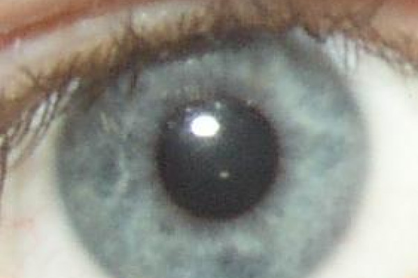 eye iris