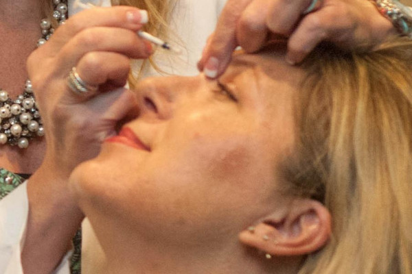 Botox