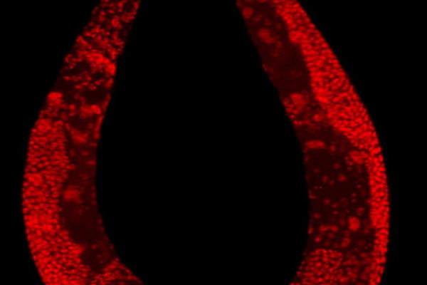 Wild-type C. elegans hermaphrodite stained to highlight the nuclei of all cells