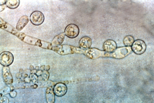 Candida albicans