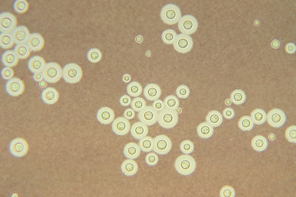 Crytococcus neoformans, a radiotrophic fungus