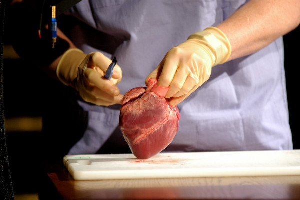 Pathology Week - Heart Attack