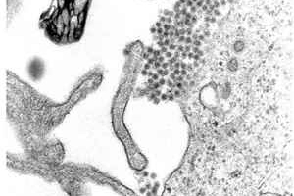 Dengue virus