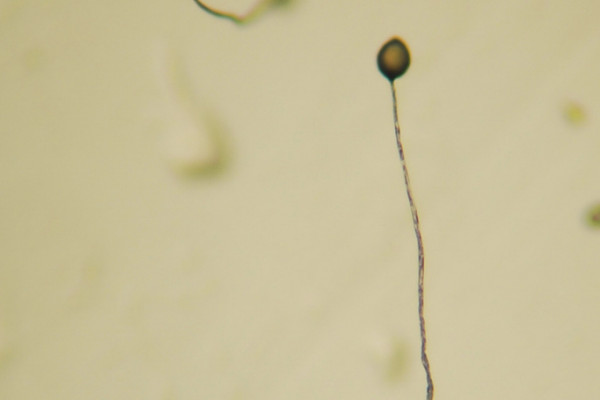Dictyostelium Fruiting Body