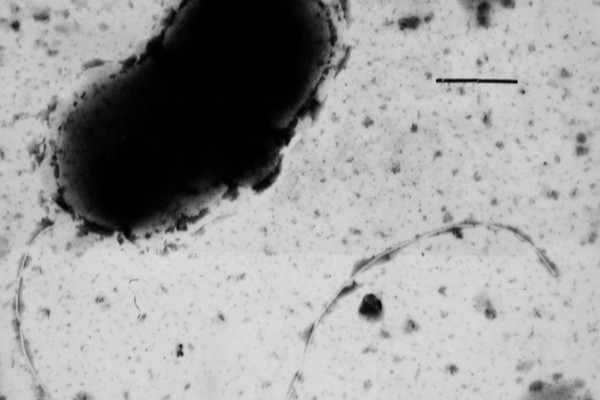 Transmission electron micrograph of sulphate reducing bacterium; Desulfovibrio vulgaris