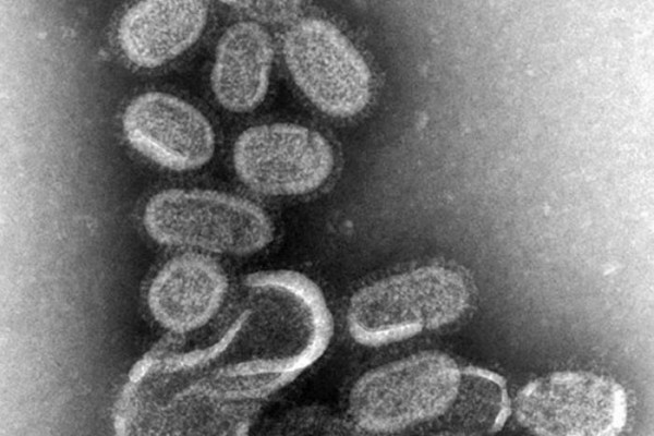 Influenza virus as seen under EM. This orthomyxovirus has pleomorphic (variable) shaped particles surrounded by a lipid envelope studded with viral proteins.