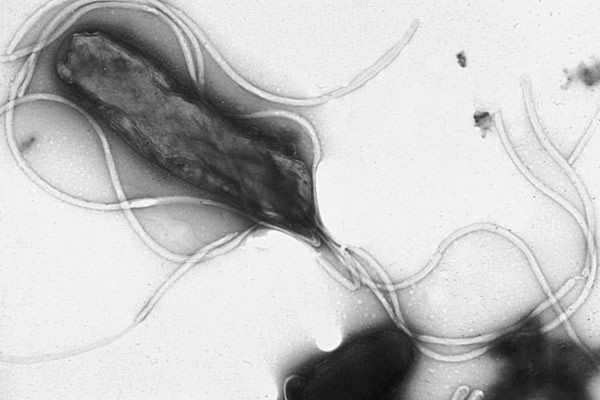 Electron micrograph of H. pylori possessing multiple flagella (negative staining)