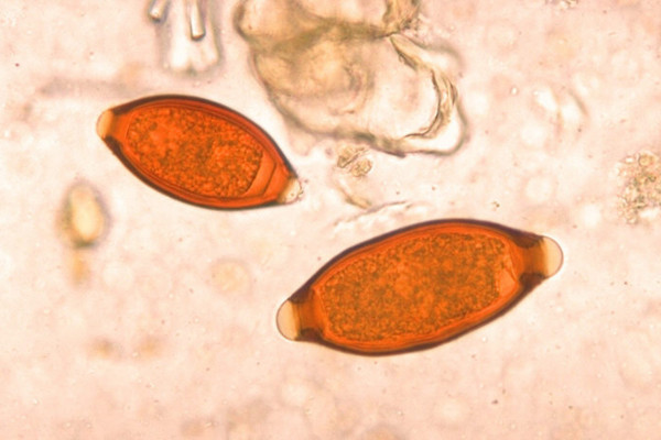 Eggs of Trichuris trichiura and Trichuris vulpis. The T. vulpis egg is the larger of the two. Parasite.