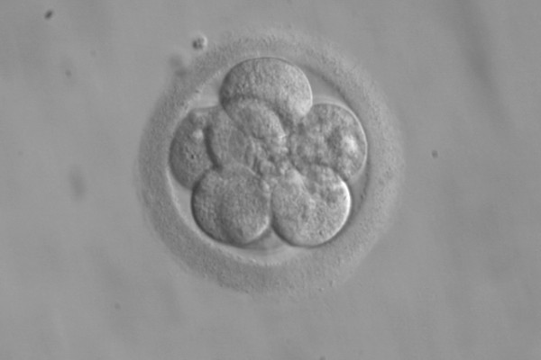 An 8 day old embryo