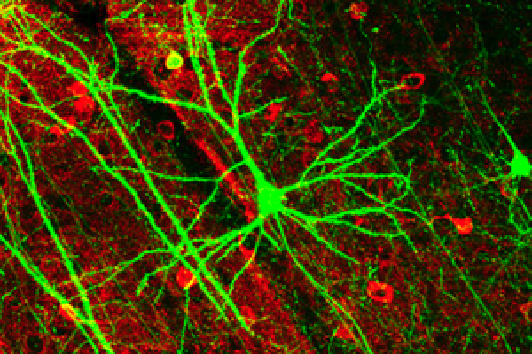 GFP-expressing nerve cells in the mouse cerebral cortex