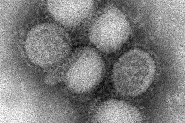 Electron micrograph showing several particles of the H1N1 influenza virus. Each particle measures about 100nm in diameter.