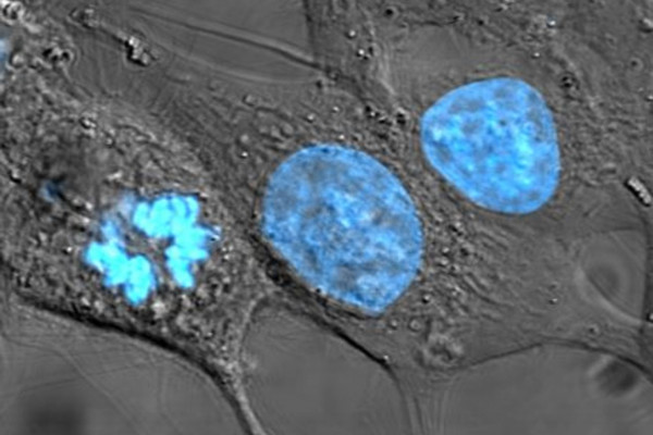 HeLa cells stained with Hoechst 33258 stain.