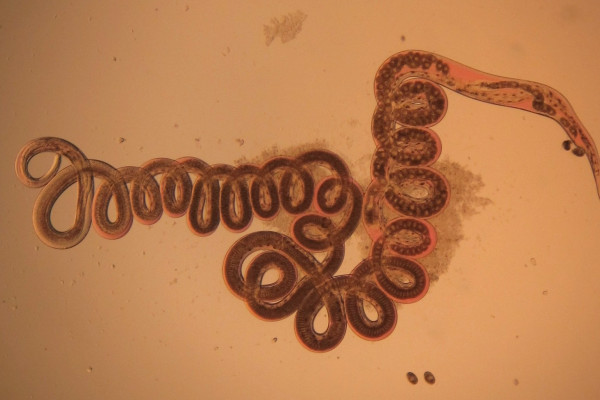 The nematode Heligmosomoides polygyrus, seen via optical microscope. Taken from the digestive tract of a wood mouse (Apodemus sylvaticus).