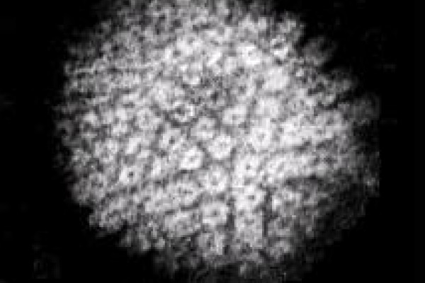 Electron micrograph of HSV particles