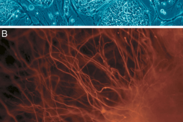 human Embryonic Stem Cells