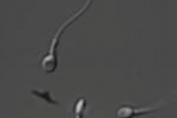 Human sperm