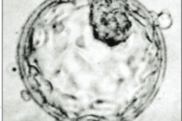 Image of human blastocyst showing Inner Cell Mass (top, right) and Trophectoderm.