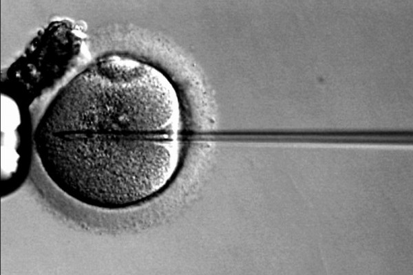 IVF technology