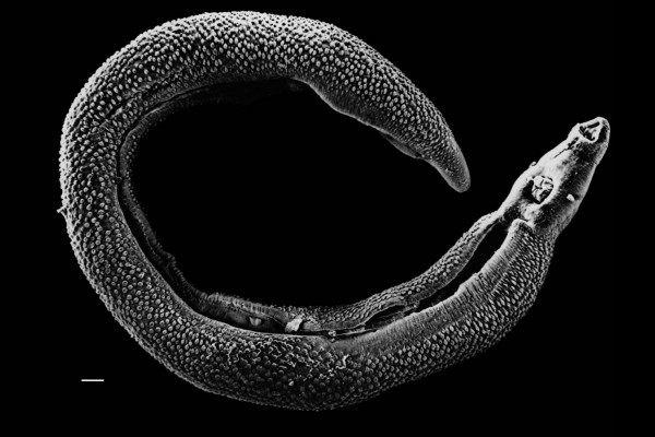 Electron micrograph of an adult male Schistosoma parasite worm. The bar (bottom left) represents a magnification of 0.5mm.