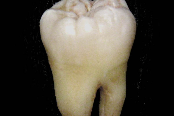 Human tooth