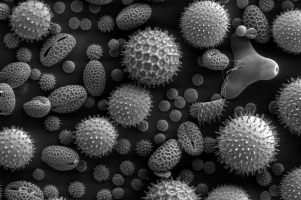An SEM of pollen grains, a common cause of allergic reactions