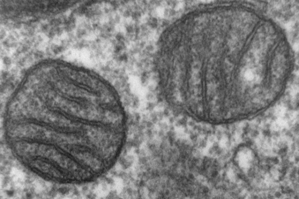 Transmission electron microscope image of a thin section cut through an area of mammalian lung tissue. The high magnification image shows a mitochondria. JEOL 100CX TEM