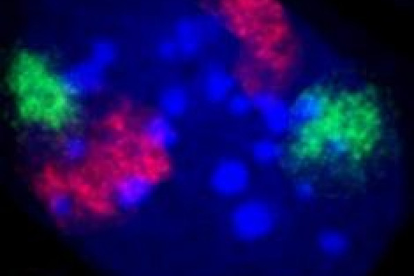 Chromosome territories in the nucleus